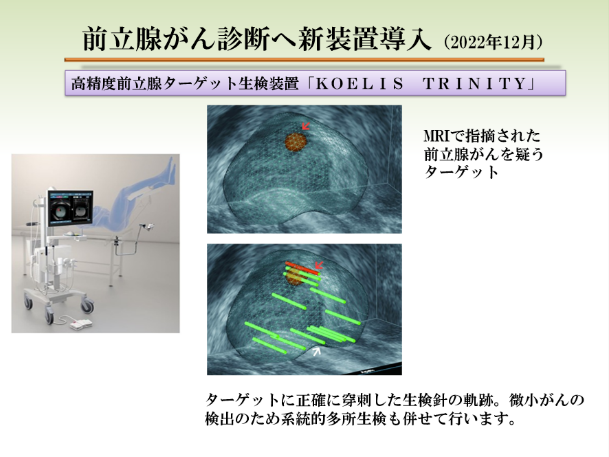 紹介画像（前立腺がん診断へ新装置導入）