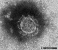 新型コロナウイルスの電子顕微鏡写真