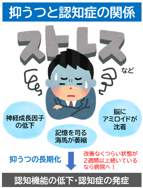 抑うつと認知症の関係
